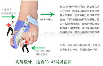 经络保健器材新选择 大拇指固定器与足部矫形器的健康守护